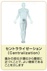 セントラライゼーション