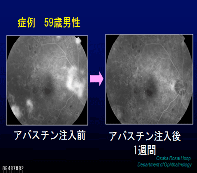 eQ̎́io^1Nj